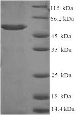 (Tris-Glycine gel) Discontinuous SDS-PAGE (reduced) with 5% enrichment gel and 15% separation gel.
