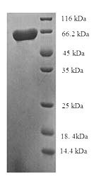 (Tris-Glycine gel) Discontinuous SDS-PAGE (reduced) with 5% enrichment gel and 15% separation gel. (Tris-Glycine gel) Discontinuous SDS-PAGE (reduced) with 5% enrichment gel and 15% separation gel.