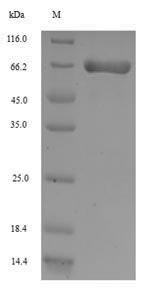(Tris-Glycine gel) Discontinuous SDS-PAGE (reduced) with 5% enrichment gel and 15% separation gel. (Tris-Glycine gel) Discontinuous SDS-PAGE (reduced) with 5% enrichment gel and 15% separation gel.