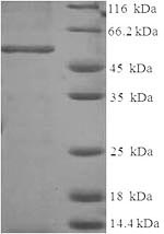 (Tris-Glycine gel) Discontinuous SDS-PAGE (reduced) with 5% enrichment gel and 15% separation gel.