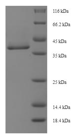 (Tris-Glycine gel) Discontinuous SDS-PAGE (reduced) with 5% enrichment gel and 15% separation gel.