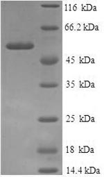 (Tris-Glycine gel) Discontinuous SDS-PAGE (reduced) with 5% enrichment gel and 15% separation gel. (Tris-Glycine gel) Discontinuous SDS-PAGE (reduced) with 5% enrichment gel and 15% separation gel.