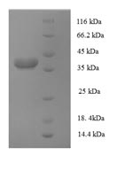 (Tris-Glycine gel) Discontinuous SDS-PAGE (reduced) with 5% enrichment gel and 15% separation gel. (Tris-Glycine gel) Discontinuous SDS-PAGE (reduced) with 5% enrichment gel and 15% separation gel.