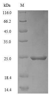 (Tris-Glycine gel) Discontinuous SDS-PAGE (reduced) with 5% enrichment gel and 15% separation gel.