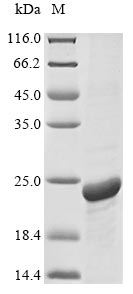 SDS-PAGE- Recombinant protein Human AQP1