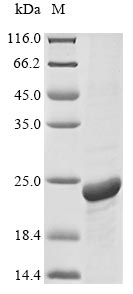 (Tris-Glycine gel) Discontinuous SDS-PAGE (reduced) with 5% enrichment gel and 15% separation gel. (Tris-Glycine gel) Discontinuous SDS-PAGE (reduced) with 5% enrichment gel and 15% separation gel.