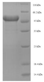 (Tris-Glycine gel) Discontinuous SDS-PAGE (reduced) with 5% enrichment gel and 15% separation gel. (Tris-Glycine gel) Discontinuous SDS-PAGE (reduced) with 5% enrichment gel and 15% separation gel.