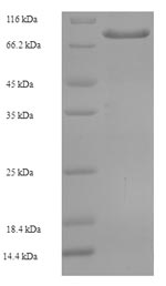 (Tris-Glycine gel) Discontinuous SDS-PAGE (reduced) with 5% enrichment gel and 15% separation gel. (Tris-Glycine gel) Discontinuous SDS-PAGE (reduced) with 5% enrichment gel and 15% separation gel.