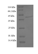 (Tris-Glycine gel) Discontinuous SDS-PAGE (reduced) with 5% enrichment gel and 15% separation gel.