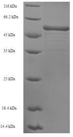 (Tris-Glycine gel) Discontinuous SDS-PAGE (reduced) with 5% enrichment gel and 15% separation gel. (Tris-Glycine gel) Discontinuous SDS-PAGE (reduced) with 5% enrichment gel and 15% separation gel.