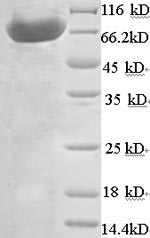 (Tris-Glycine gel) Discontinuous SDS-PAGE (reduced) with 5% enrichment gel and 15% separation gel. (Tris-Glycine gel) Discontinuous SDS-PAGE (reduced) with 5% enrichment gel and 15% separation gel.