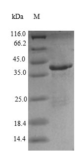 (Tris-Glycine gel) Discontinuous SDS-PAGE (reduced) with 5% enrichment gel and 15% separation gel. (Tris-Glycine gel) Discontinuous SDS-PAGE (reduced) with 5% enrichment gel and 15% separation gel.