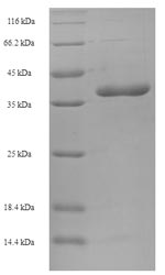 SDS-PAGE- Recombinant protein Human BCL2L11