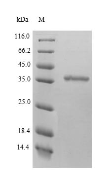 (Tris-Glycine gel) Discontinuous SDS-PAGE (reduced) with 5% enrichment gel and 15% separation gel. (Tris-Glycine gel) Discontinuous SDS-PAGE (reduced) with 5% enrichment gel and 15% separation gel.