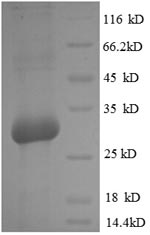 SDS-PAGE- Recombinant protein Rat Bglap