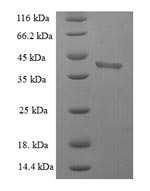(Tris-Glycine gel) Discontinuous SDS-PAGE (reduced) with 5% enrichment gel and 15% separation gel. (Tris-Glycine gel) Discontinuous SDS-PAGE (reduced) with 5% enrichment gel and 15% separation gel.
