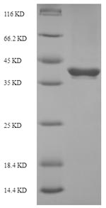 (Tris-Glycine gel) Discontinuous SDS-PAGE (reduced) with 5% enrichment gel and 15% separation gel. (Tris-Glycine gel) Discontinuous SDS-PAGE (reduced) with 5% enrichment gel and 15% separation gel.