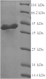 (Tris-Glycine gel) Discontinuous SDS-PAGE (reduced) with 5% enrichment gel and 15% separation gel. (Tris-Glycine gel) Discontinuous SDS-PAGE (reduced) with 5% enrichment gel and 15% separation gel.