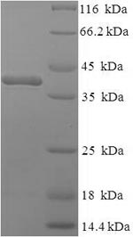 (Tris-Glycine gel) Discontinuous SDS-PAGE (reduced) with 5% enrichment gel and 15% separation gel. (Tris-Glycine gel) Discontinuous SDS-PAGE (reduced) with 5% enrichment gel and 15% separation gel.