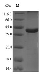 (Tris-Glycine gel) Discontinuous SDS-PAGE (reduced) with 5% enrichment gel and 15% separation gel. (Tris-Glycine gel) Discontinuous SDS-PAGE (reduced) with 5% enrichment gel and 15% separation gel.