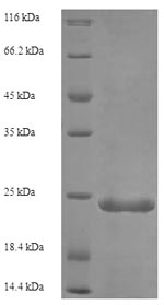 (Tris-Glycine gel) Discontinuous SDS-PAGE (reduced) with 5% enrichment gel and 15% separation gel. (Tris-Glycine gel) Discontinuous SDS-PAGE (reduced) with 5% enrichment gel and 15% separation gel.