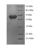 (Tris-Glycine gel) Discontinuous SDS-PAGE (reduced) with 5% enrichment gel and 15% separation gel.