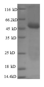 (Tris-Glycine gel) Discontinuous SDS-PAGE (reduced) with 5% enrichment gel and 15% separation gel. (Tris-Glycine gel) Discontinuous SDS-PAGE (reduced) with 5% enrichment gel and 15% separation gel.