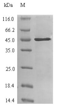 (Tris-Glycine gel) Discontinuous SDS-PAGE (reduced) with 5% enrichment gel and 15% separation gel.
