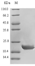 (Tris-Glycine gel) Discontinuous SDS-PAGE (reduced) with 5% enrichment gel and 15% separation gel. (Tris-Glycine gel) Discontinuous SDS-PAGE (reduced) with 5% enrichment gel and 15% separation gel.