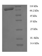 (Tris-Glycine gel) Discontinuous SDS-PAGE (reduced) with 5% enrichment gel and 15% separation gel. (Tris-Glycine gel) Discontinuous SDS-PAGE (reduced) with 5% enrichment gel and 15% separation gel.