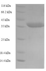 (Tris-Glycine gel) Discontinuous SDS-PAGE (reduced) with 5% enrichment gel and 15% separation gel. (Tris-Glycine gel) Discontinuous SDS-PAGE (reduced) with 5% enrichment gel and 15% separation gel.