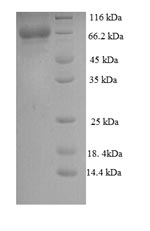 (Tris-Glycine gel) Discontinuous SDS-PAGE (reduced) with 5% enrichment gel and 15% separation gel. (Tris-Glycine gel) Discontinuous SDS-PAGE (reduced) with 5% enrichment gel and 15% separation gel.