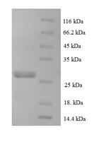 (Tris-Glycine gel) Discontinuous SDS-PAGE (reduced) with 5% enrichment gel and 15% separation gel. (Tris-Glycine gel) Discontinuous SDS-PAGE (reduced) with 5% enrichment gel and 15% separation gel.