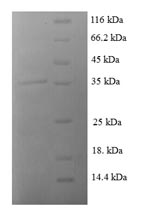 SDS-PAGE- Recombinant protein Human CCL8