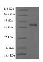 SDS-PAGE- Recombinant protein Human CCND1