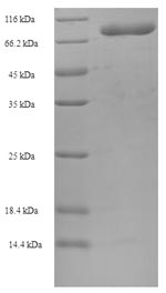 (Tris-Glycine gel) Discontinuous SDS-PAGE (reduced) with 5% enrichment gel and 15% separation gel. (Tris-Glycine gel) Discontinuous SDS-PAGE (reduced) with 5% enrichment gel and 15% separation gel.