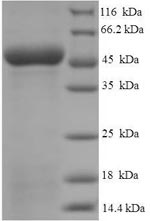(Tris-Glycine gel) Discontinuous SDS-PAGE (reduced) with 5% enrichment gel and 15% separation gel. (Tris-Glycine gel) Discontinuous SDS-PAGE (reduced) with 5% enrichment gel and 15% separation gel.