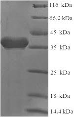 SDS-PAGE- Recombinant protein Human CD2