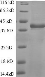 SDS-PAGE- Recombinant protein Human CD7