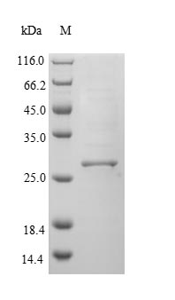 (Tris-Glycine gel) Discontinuous SDS-PAGE (reduced) with 5% enrichment gel and 15% separation gel. (Tris-Glycine gel) Discontinuous SDS-PAGE (reduced) with 5% enrichment gel and 15% separation gel.