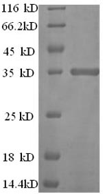 SDS-PAGE- Recombinant protein Mouse Cd81