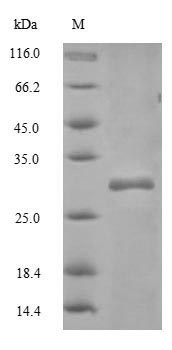 (Tris-Glycine gel) Discontinuous SDS-PAGE (reduced) with 5% enrichment gel and 15% separation gel. (Tris-Glycine gel) Discontinuous SDS-PAGE (reduced) with 5% enrichment gel and 15% separation gel.