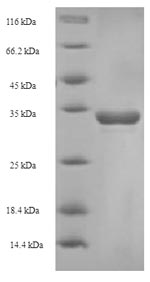 (Tris-Glycine gel) Discontinuous SDS-PAGE (reduced) with 5% enrichment gel and 15% separation gel. (Tris-Glycine gel) Discontinuous SDS-PAGE (reduced) with 5% enrichment gel and 15% separation gel.