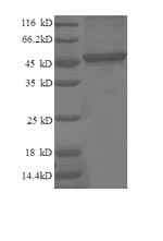 SDS-PAGE- Recombinant protein Human CDKN1A