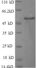 (Tris-Glycine gel) Discontinuous SDS-PAGE (reduced) with 5% enrichment gel and 15% separation gel. (Tris-Glycine gel) Discontinuous SDS-PAGE (reduced) with 5% enrichment gel and 15% separation gel.