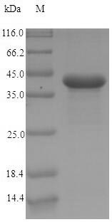 (Tris-Glycine gel) Discontinuous SDS-PAGE (reduced) with 5% enrichment gel and 15% separation gel. (Tris-Glycine gel) Discontinuous SDS-PAGE (reduced) with 5% enrichment gel and 15% separation gel.