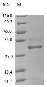 SDS-PAGE- Recombinant protein Rat Cfd