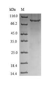 (Tris-Glycine gel) Discontinuous SDS-PAGE (reduced) with 5% enrichment gel and 15% separation gel. (Tris-Glycine gel) Discontinuous SDS-PAGE (reduced) with 5% enrichment gel and 15% separation gel.