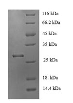 CSB-EP005386MO SDS-PAGE