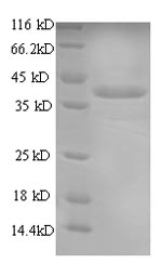(Tris-Glycine gel) Discontinuous SDS-PAGE (reduced) with 5% enrichment gel and 15% separation gel. (Tris-Glycine gel) Discontinuous SDS-PAGE (reduced) with 5% enrichment gel and 15% separation gel.